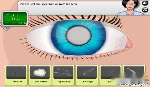 眼部手术攻略图文流程详解 第3张